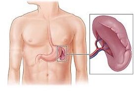 sol omuz bıçağının altında ağrı nedeni olarak dalak patolojisi