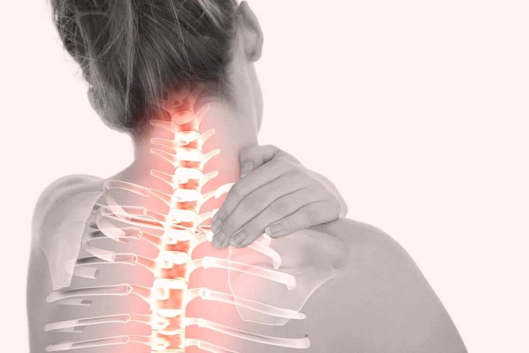 Osteokondroz nedeniyle servikal omurgada ağrı