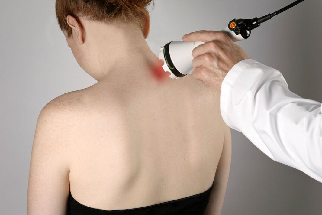 Servikal osteokondrozun fizyoterapötik tedavisi